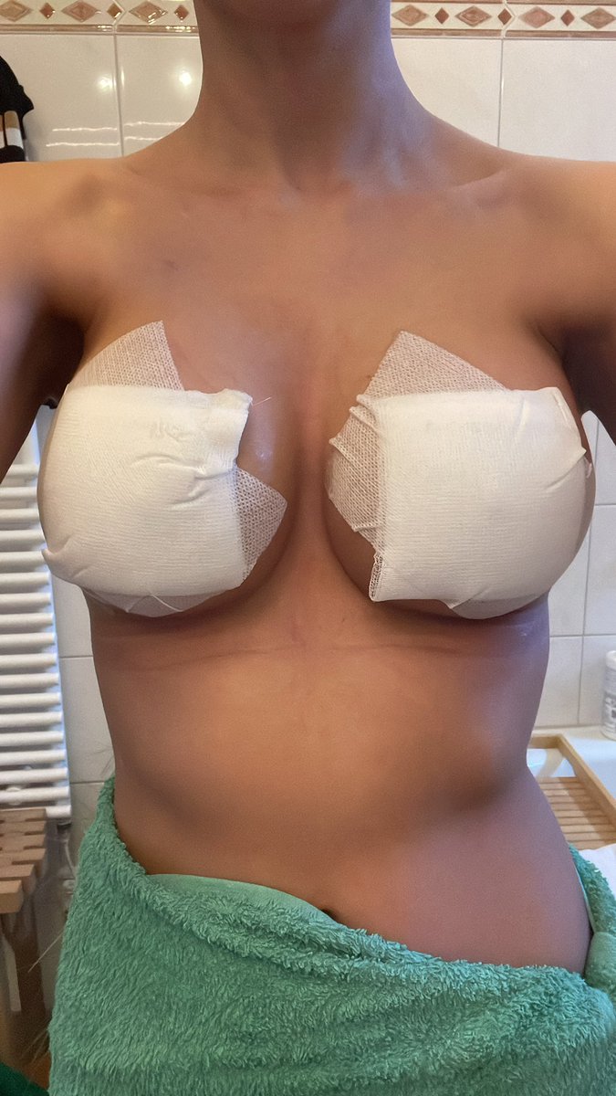 yourgermanmuse's tweet photo. My boobs are almost two years old 🥺✨🍾 https://t.co/8xtshCF7R0