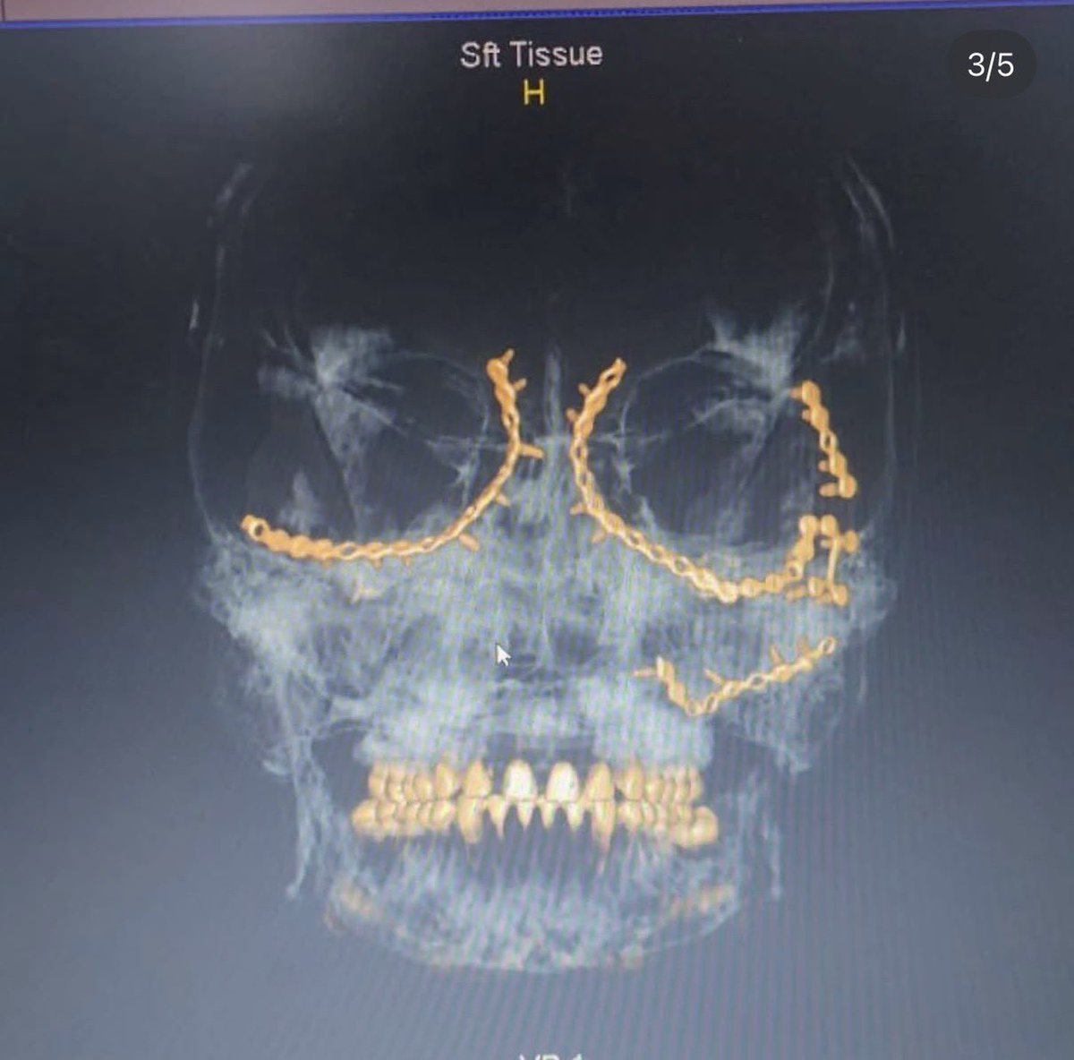 Hugovical tweet media