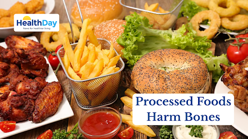 HealthDayTweets's tweet image. Eating too many ultra-processed foods lowers bone mineral density and raises the risk of hip fracture, researchers warn.

youtu.be/I_zjdJb7uGU

#UltraProcessedFoods #BoneHealth #BoneDensity #HealthyEating #NutritionResearch
