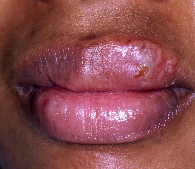 Doctor Ladegah🩺🔛 tweet media