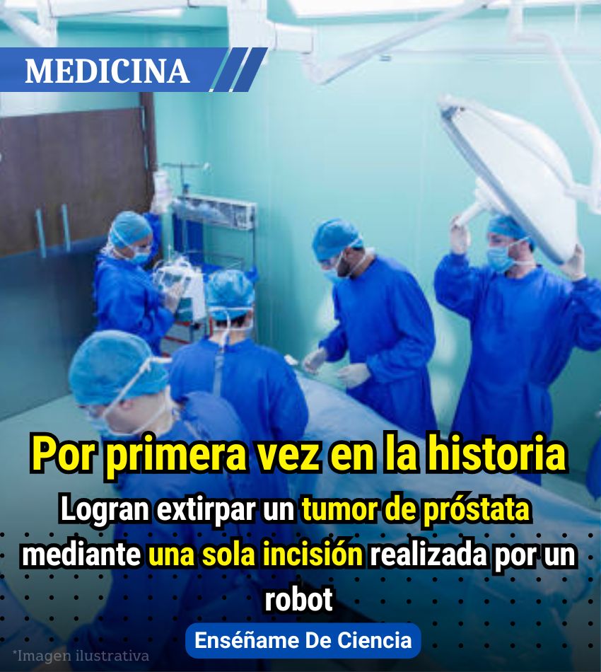💥Un equipo de médicos cirujanos del Hospital Álvaro Cunqueiro de Vigo, ha logrado marcar un hito dentro de la medicina. Por primera vez, se ha logrado extirpar un tumor de próstata por medio de cirugía robótica. Otro asombroso detalle es que se logró utilizando solamente una
