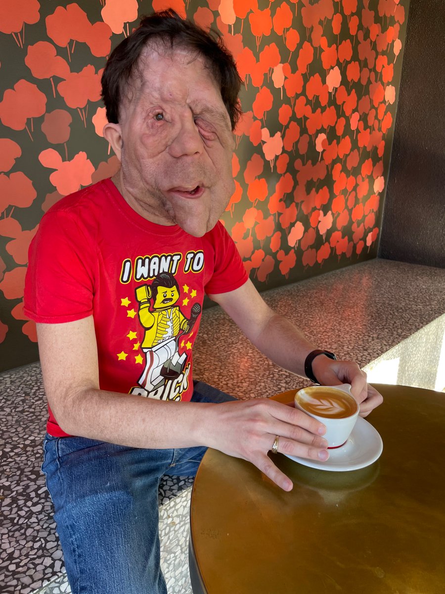 Adam Pearson tweet media