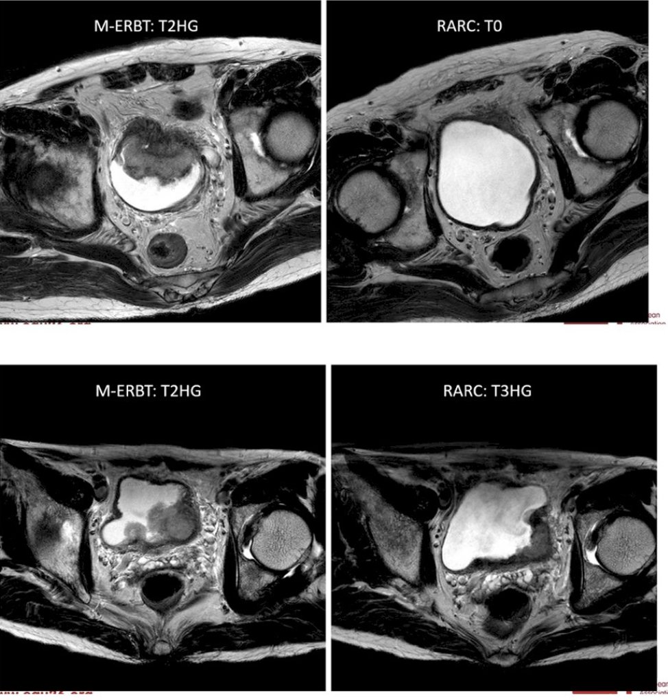 UroToday.com tweet media