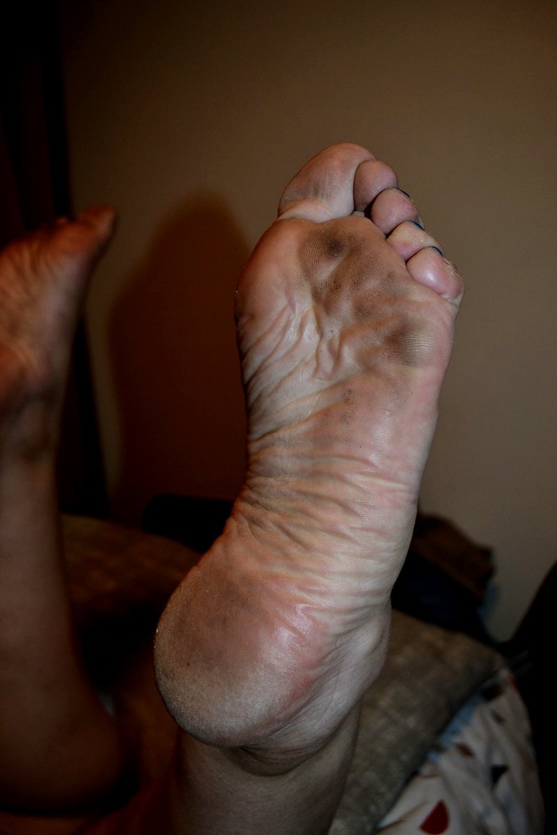 Hants_Foot_CoupleUK🇬🇧 tweet media