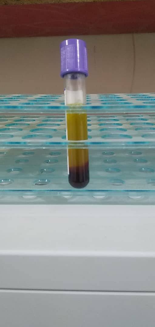 ALI ALKHALIFAH |:| عـلـي الخـليـفـة tweet media