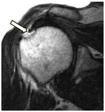 afra almarar tweet media