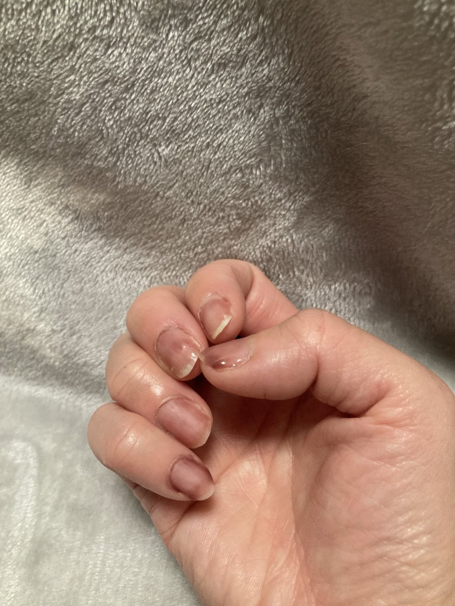 mofmofattack's tweet photo. 初めてのジェルネイル
泥遊びした後、泥が落ちない人みたいになってしまった🤣

カラーとトップコートを間違えたみたいで…笑笑 https://t.co/kzCLsihoV7