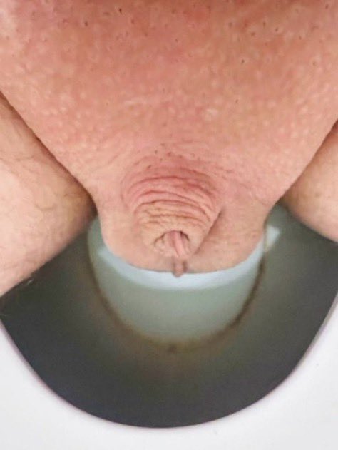 TRANSITION THERAPEUTICS tweet media