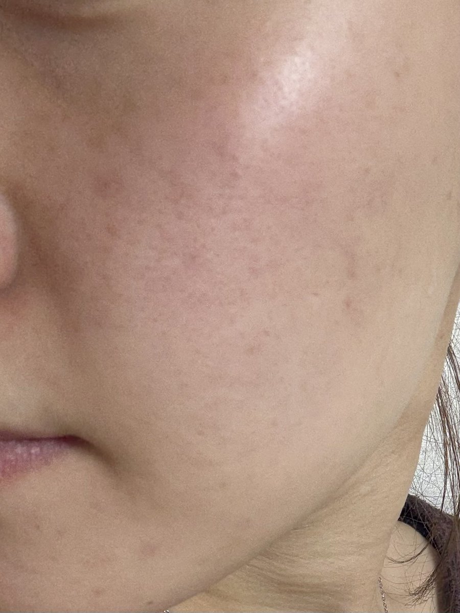 유이크 UIQ tweet media