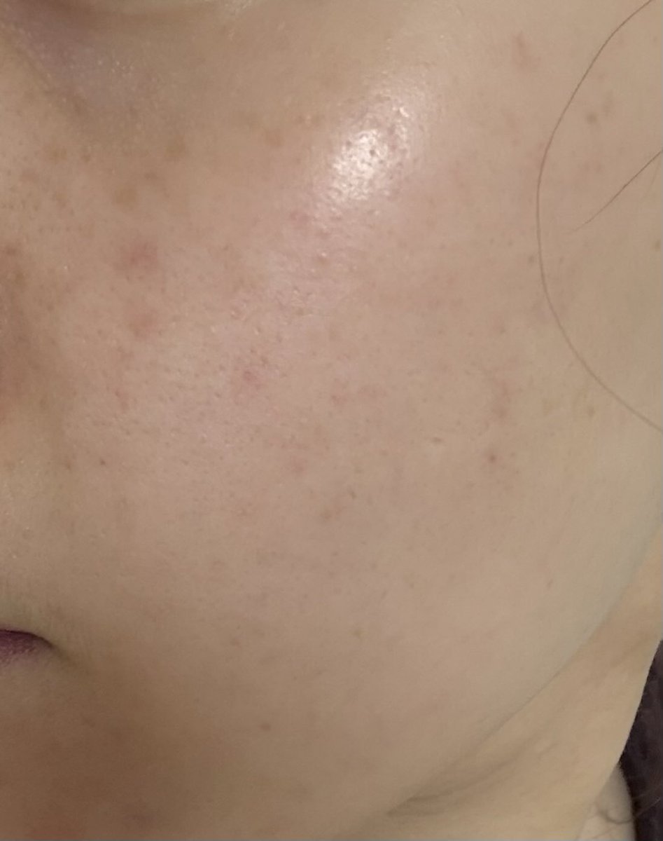 유이크 UIQ tweet media