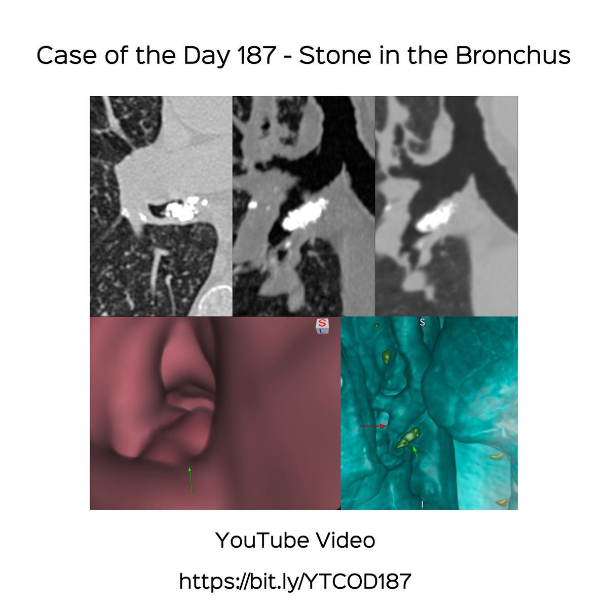 Bhavin Jankharia tweet media