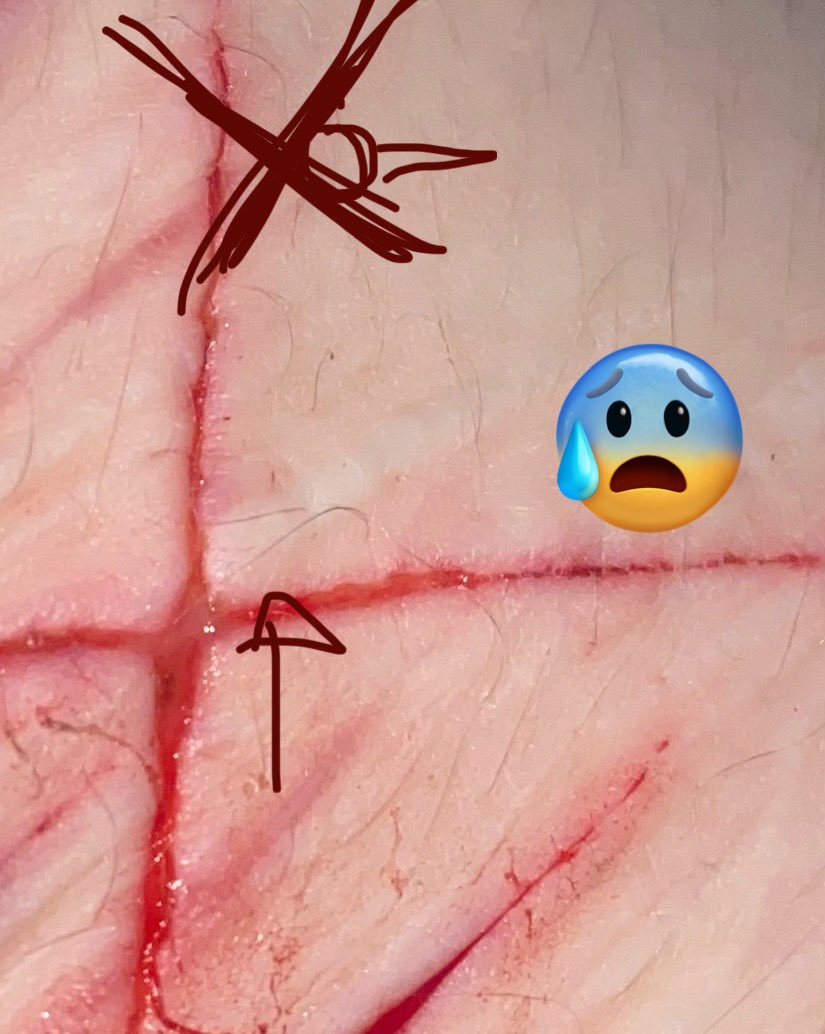 ⭐️ | 𝙩𝙨𝙪𝙠𝙖𝙨𝙖 𝙩𝙚𝙣𝙢𝙖 | 𝙨𝙝𝙚𝙙𝙩𝙬𝙩 ཀ tweet media