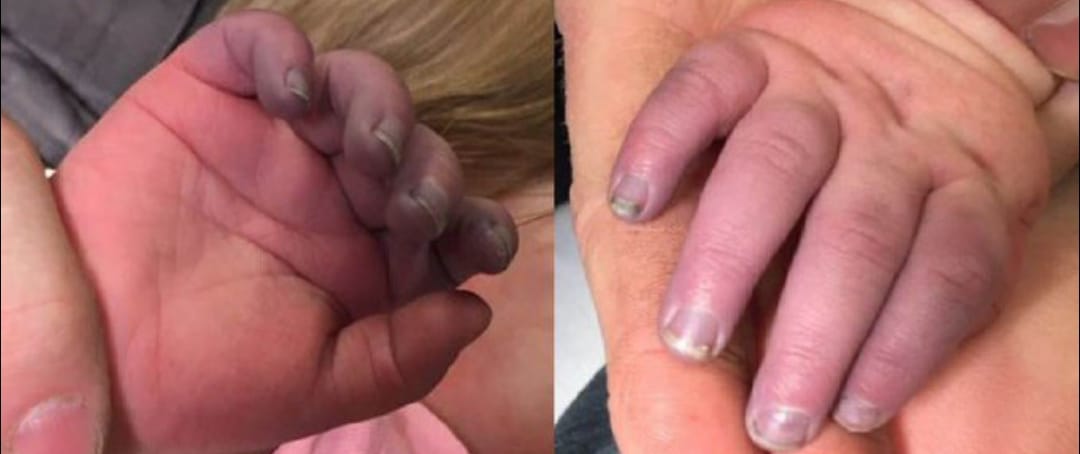 Yousef in Gaza 🇵🇸 tweet media