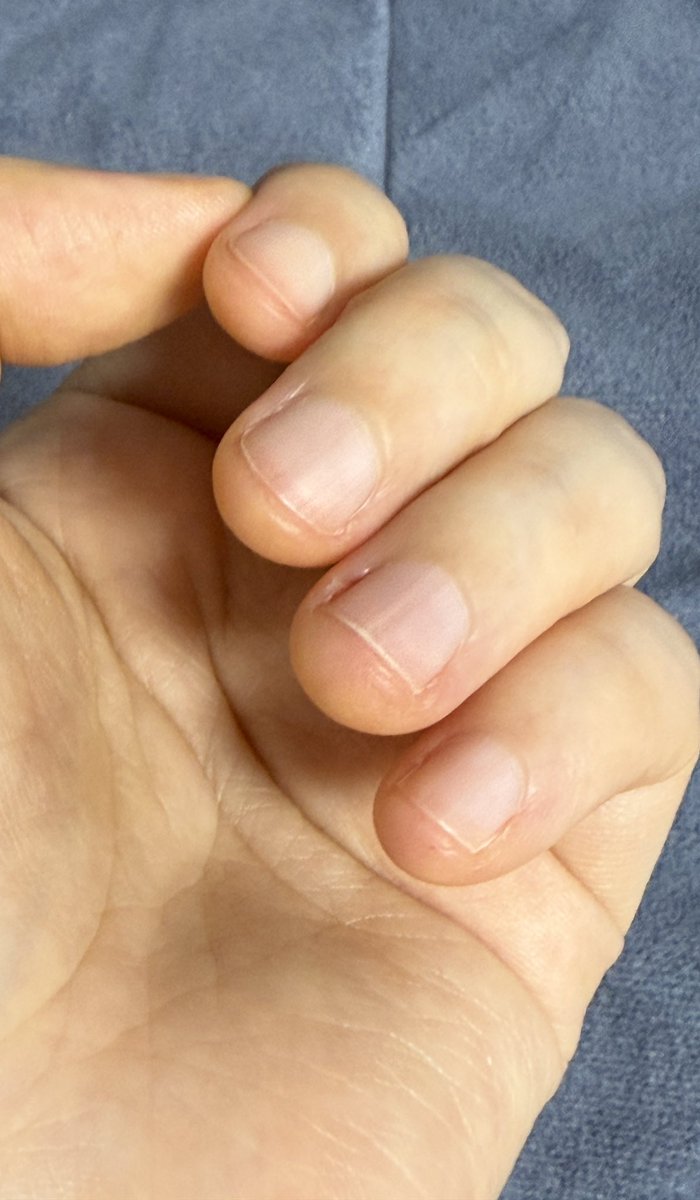 헤비약이🐤(상태:억까) tweet media