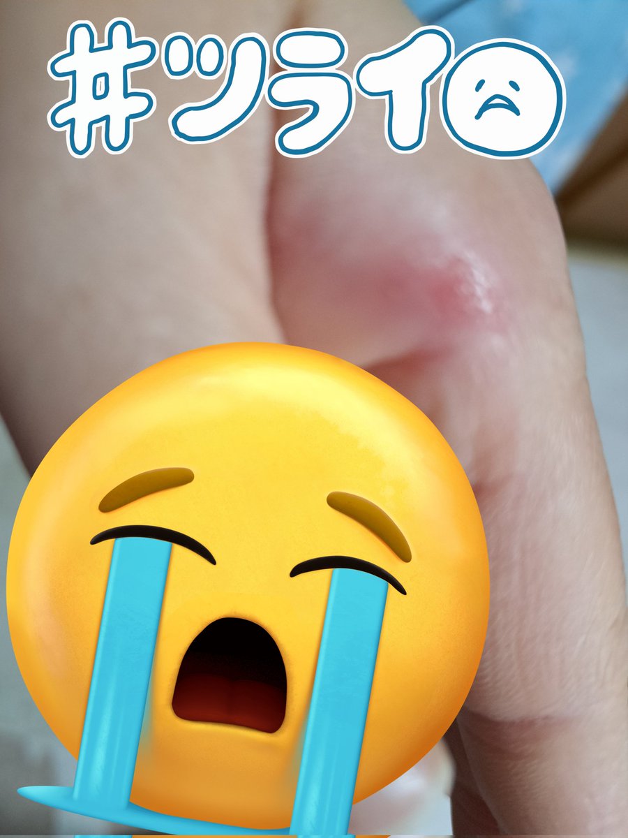 こんにちは✨😃❗
まだ皮剥けたの痛いんだけど、それに朝起きたら両腕に親指の付け根に筋肉痛で…😢
今日もまだ脱水機直ってないんやろか？？？また手で絞りか？？？勘弁してほしーーー😭
日曜日はそうでなくても忙しいのにーーーー！