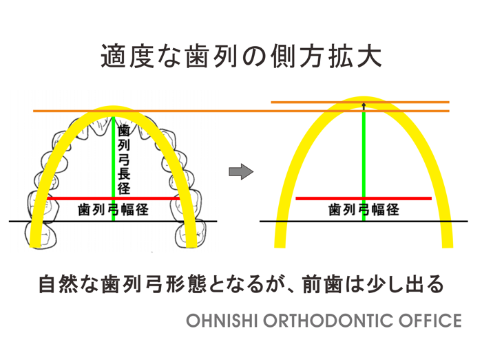 e_hanarabi's tweet photo. 矯正つれづれ叢に「歯並びを広げると、口元が下がるという誤解」を追加いたしました。
https://t.co/zuvcAM6hzT https://t.co/sbBVk3mCde
