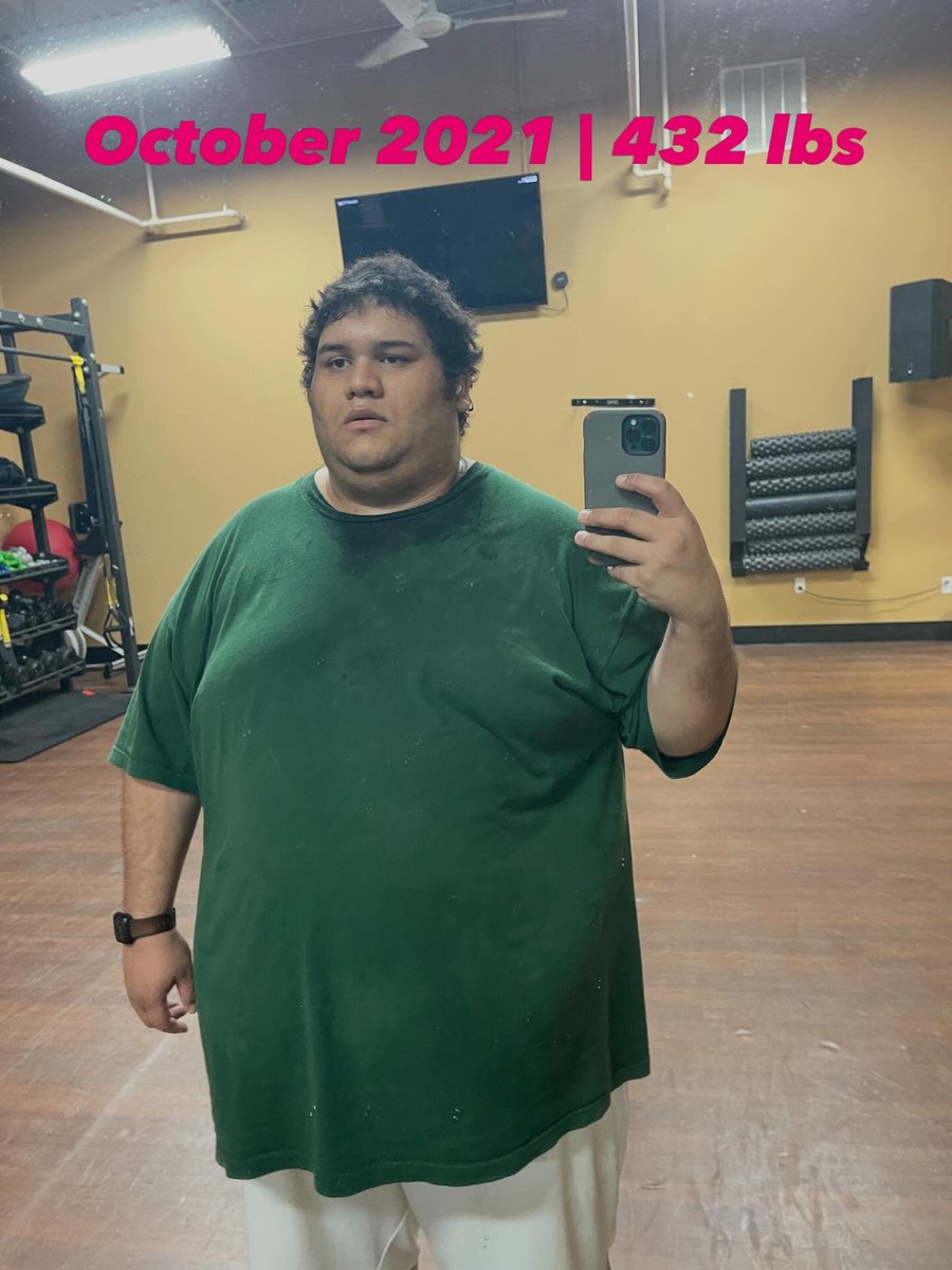 themrtaco's tweet photo. Thought I'd share, I'll admit I still don't feel confident or see if I ever will but seeing the difference side by side helps. Nope to one day fel comfortable in my own skin. https://t.co/6qGz1mI6D3