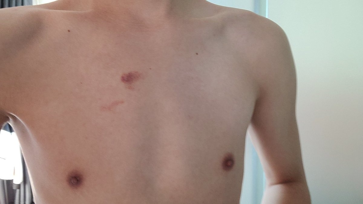 牟太奇 tweet media