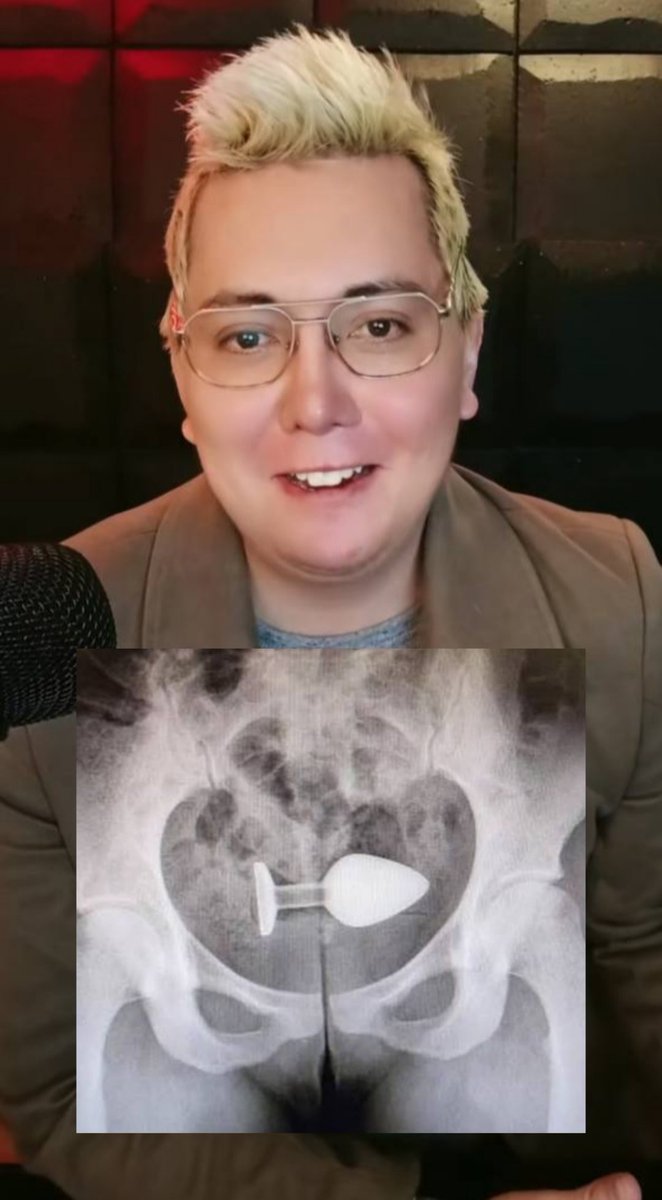 Pronta recuperación <a href="/conejo_oligarca/">Conejo Oligarca</a> .
Se rumora qué está hospitalizado debido a que un objeto extraño apareció misteriosamente en su colón descendente.