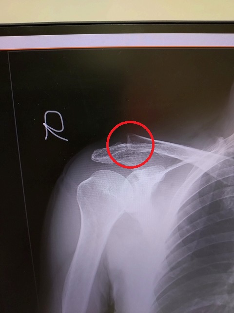 Ryou@リノベ大家 収益不動産 売買相談所 tweet media