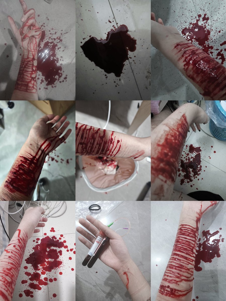 你的吻是未愈的淤青 tweet media