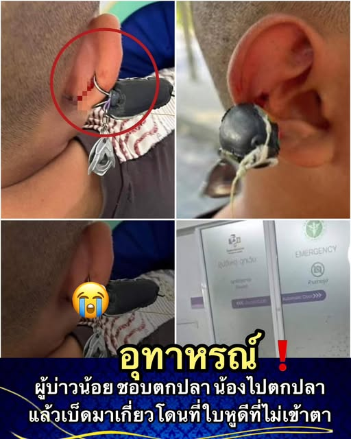 monner777's tweet photo. อุทาหรณ์ 📷 น้องอยู่ใกล้บ้านเราน้องไปตกปลาแล้วเบ็ดมาเกี่ยวโดนที่ใบหูดีที่ไม่เข้าตา.…….
โยน ระวังกันด้วยนะคะ  หนุ่มๆ หัดตกปลา https://t.co/oXeyZglE7T