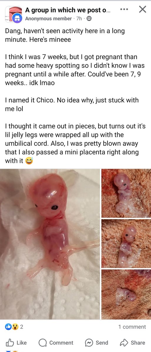 𝚌𝚕𝚞𝚖𝚙 𝚘𝚏 𝚌𝚎𝚕𝚕𝚜 tweet media