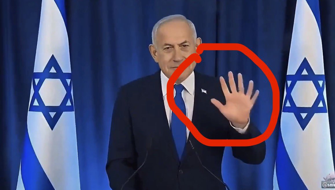 JonStewartIL's tweet image. Ok, Uncle Jon is calling this one AI!!!

Six fingers!!!! 

#IranIsraelWar #NetanyahuDead
