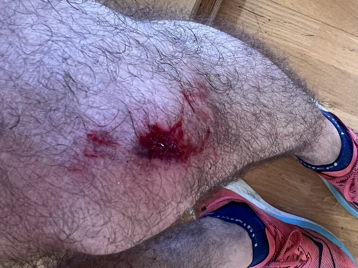 Charles Davis tweet media