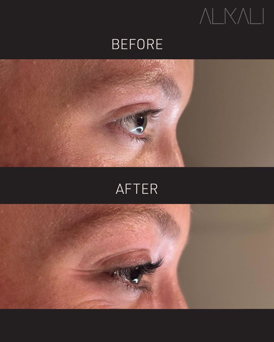 AlkaliHair's tweet image. Check out this beautiful lash lift + tint Becca Sizemore did for her client Hillary! 😍

Book with Becca online today for beautiful lashes, skin, or a YUME Japanese head spa or call 336-724-1453.
bit.ly/439DStL 

#lashlift #lashtint #alkaliwsnc