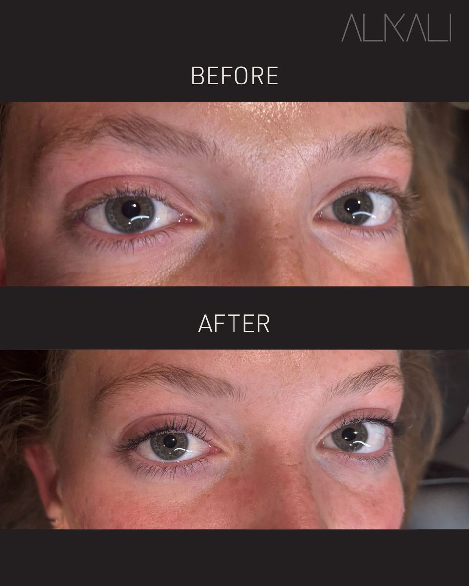 AlkaliHair's tweet image. Check out this beautiful lash lift + tint Becca Sizemore did for her client Hillary! 😍

Book with Becca online today for beautiful lashes, skin, or a YUME Japanese head spa or call 336-724-1453.
bit.ly/439DStL 

#lashlift #lashtint #alkaliwsnc
