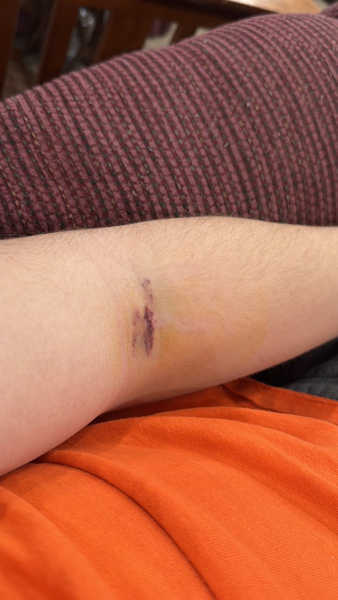 Jonny “baldballs”McTingles tweet media