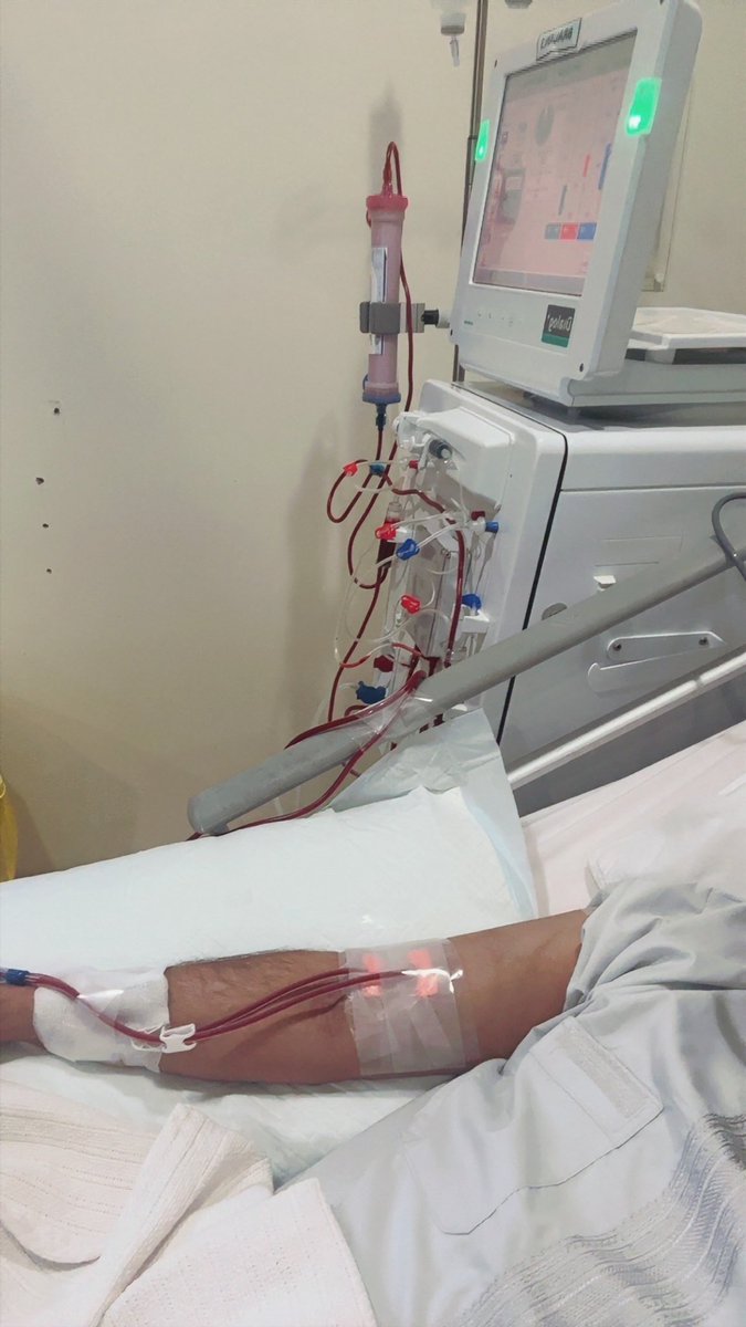 احتاج ايباد وانا هنا 😔