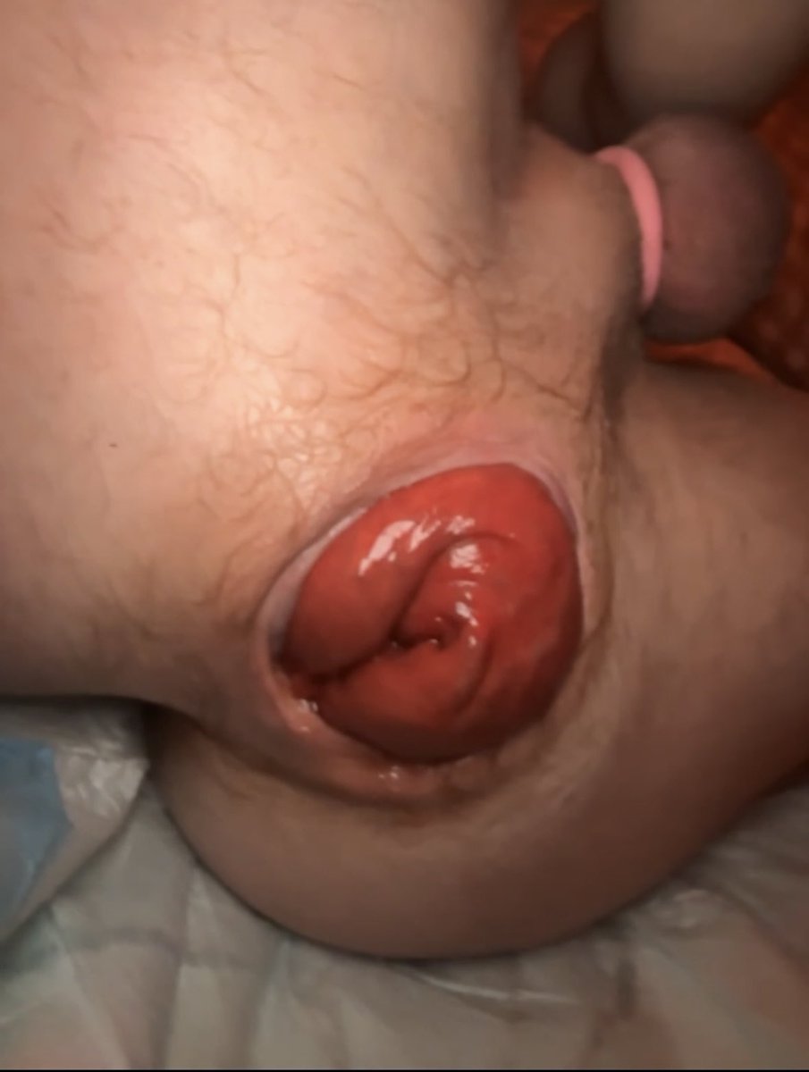 FreakFFag tweet media