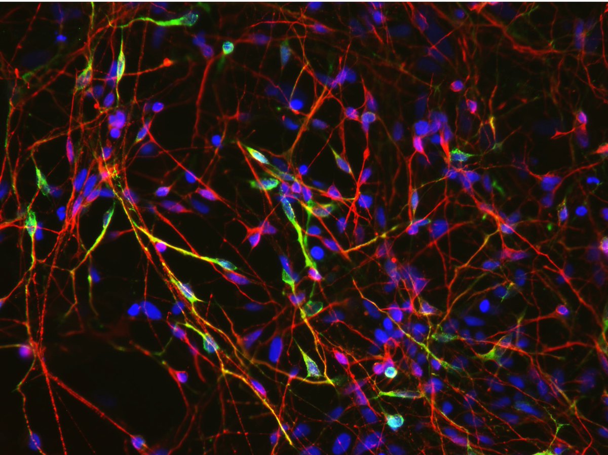 fascinatingonX's tweet photo. 🚨 BREAKING: Japan becomes first to approve stem cell therapies for Parkinson’s and heart failure. https://t.co/ojlmPL2lyC
