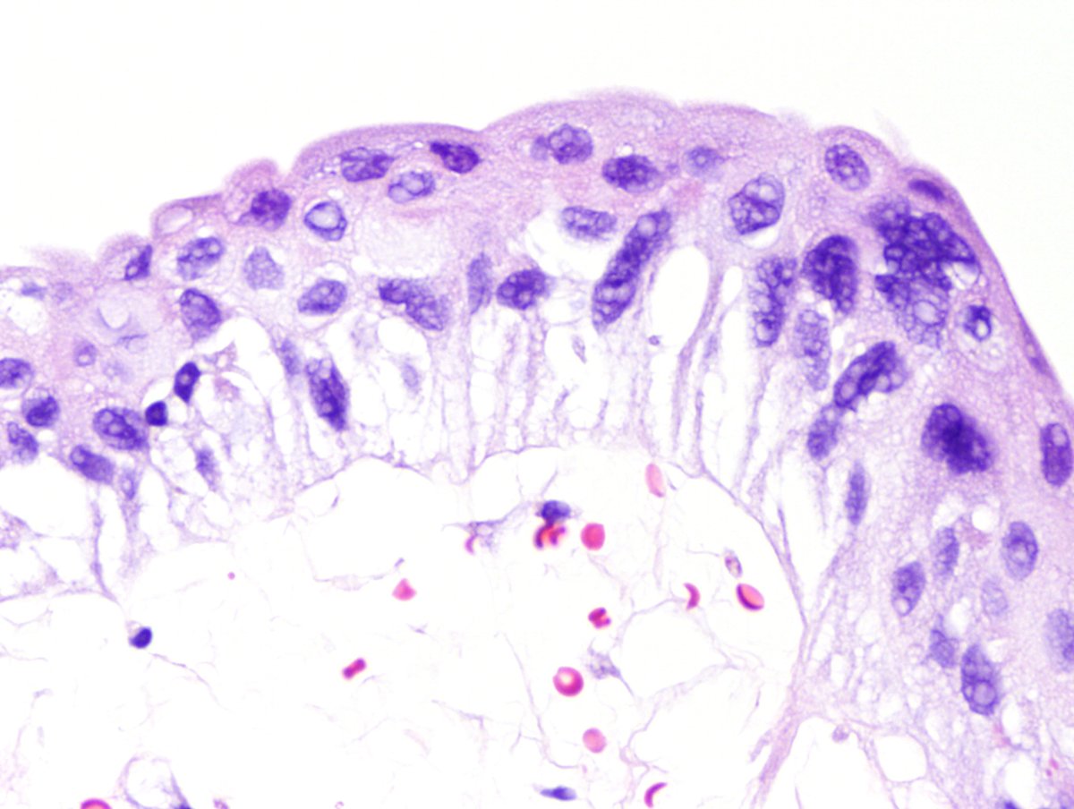 Andres Matoso tweet media