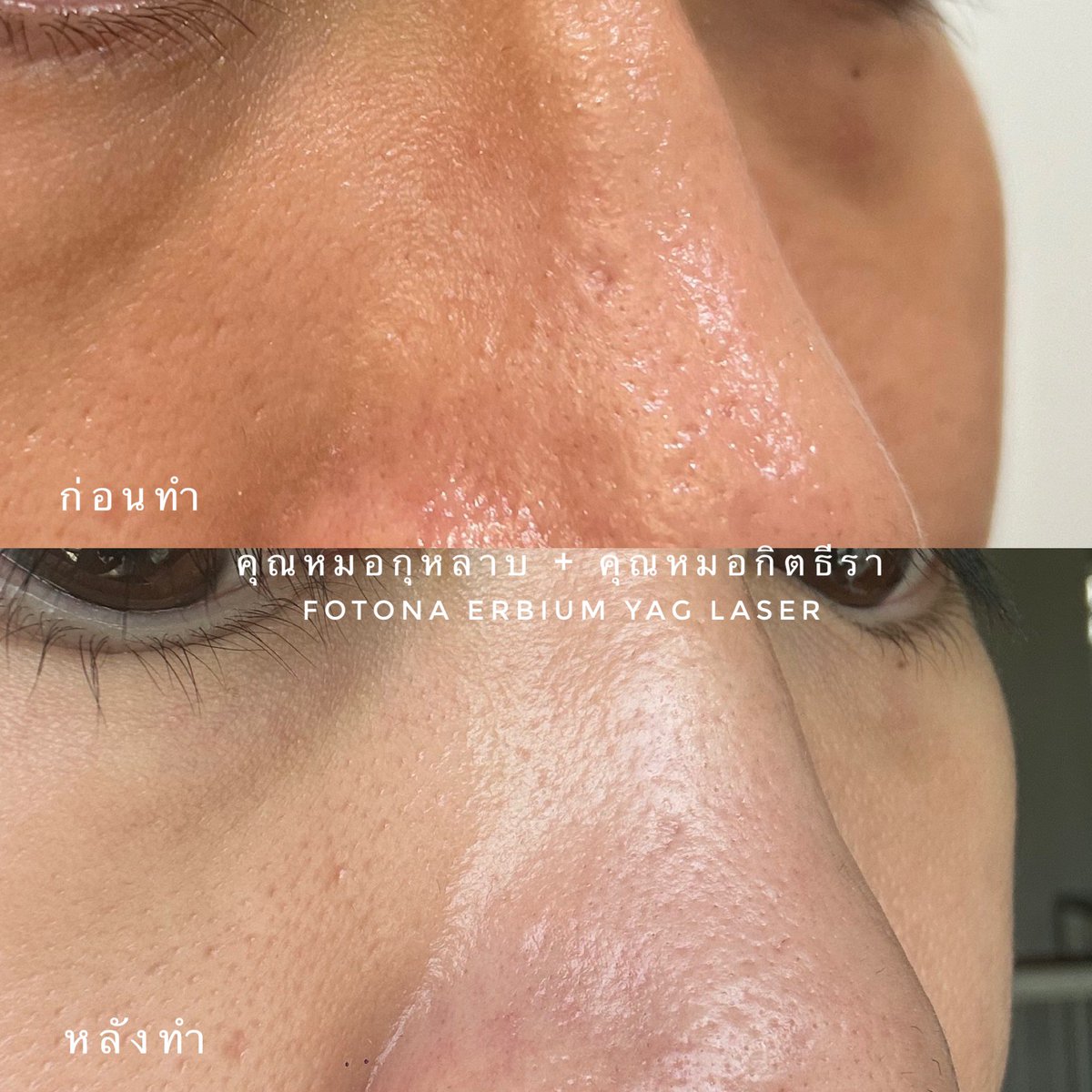 Grumpy Teddy tweet media