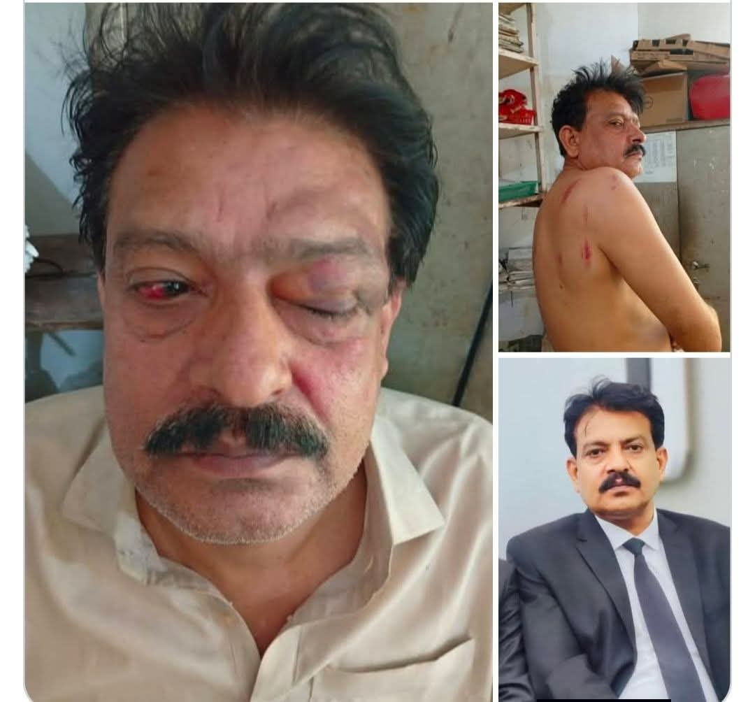 سنڌ پرست وڪيل ۽ محبوب انسان 
سائين ڌڻي بخش سولنگيءَ مٿان 
رياستي تشدد جي سخت  لفظن ۾ مذمت ڪجي ٿي!
#JusticeForAdvDhaniBuxSolangi
<a href="/IGSindh/">IG Sindh</a> <a href="/SindhPoliceDMC/">Sindh Police</a>