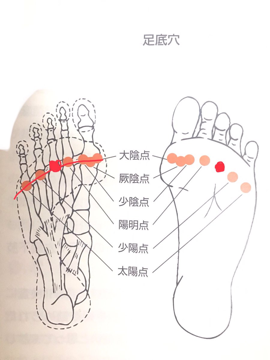 花粉症の鼻水は、ツボを選定し

灸をすれば、ピタリと止まる。

目の痒みはどうか？

これも、成功する確率は高い。

ちなみに、今年は

幻のツボー足底穴を花粉症対策のツボに

デビューさせてみた。

（※ライン上で圧痛点を探す

複数穴、出現する場合あり）

お試しあれ