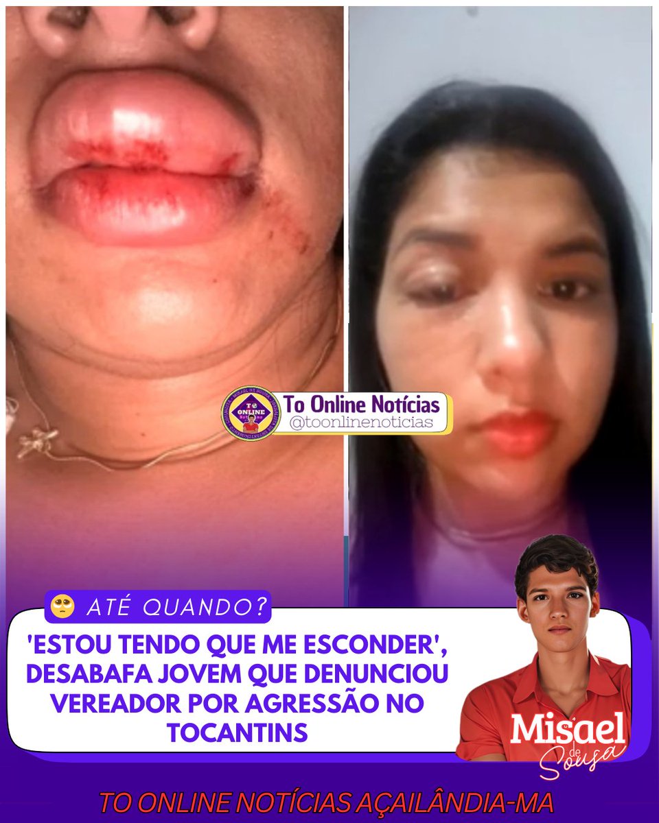 Toonlinenoticia's tweet image. "Estou tendo que me esconder": Yorrana Dias de Sousa desabafa após denunciar vereador Ammon Eduardo (União) por agressão em Maurilândia (TO). Caso em janeiro/2026. Justiça! Matéria completa no Facebook: facebook.com/share/p/1HiLFm… #AgressãoVereador #MaurilândiaTO