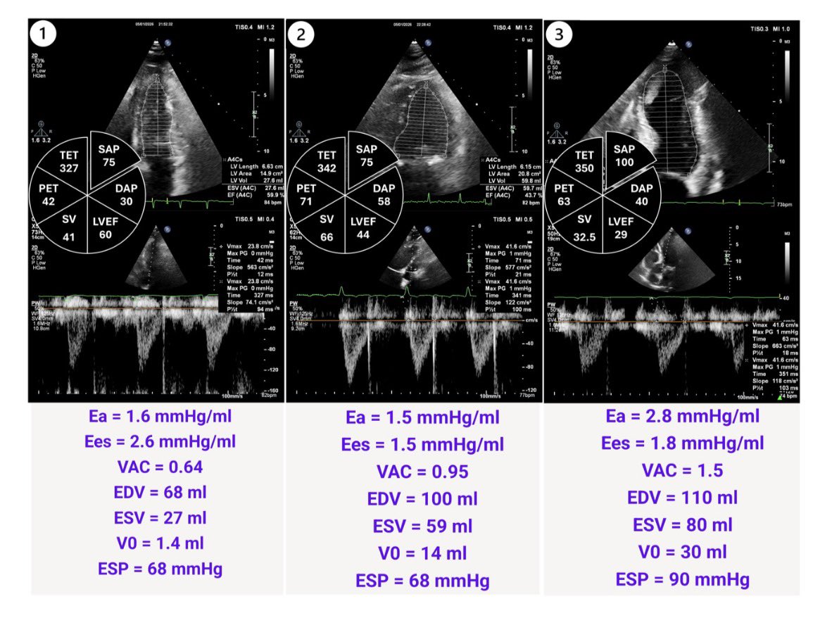 Hatem Soliman Aboumarie, FRCP, FEACVI, FASE, FHEA tweet media