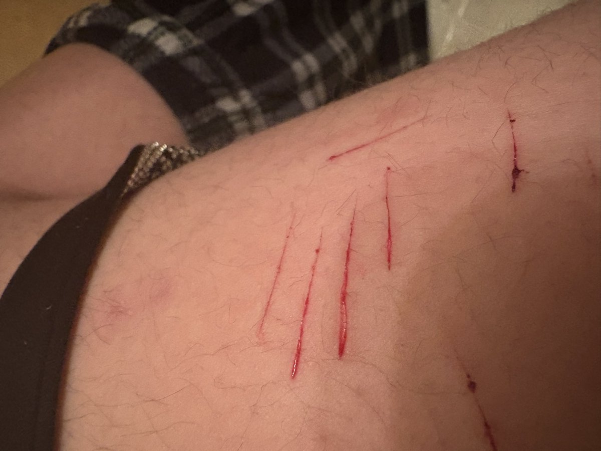 Realme_9873's tweet photo. Oh shoot I forgot I posted this and didn’t even post the photos but HERE THEY AREEE >: P #shtwt #edtwt #shedtwt #catscratch #bbstyro #babystyro https://t.co/pM0bPN40TF