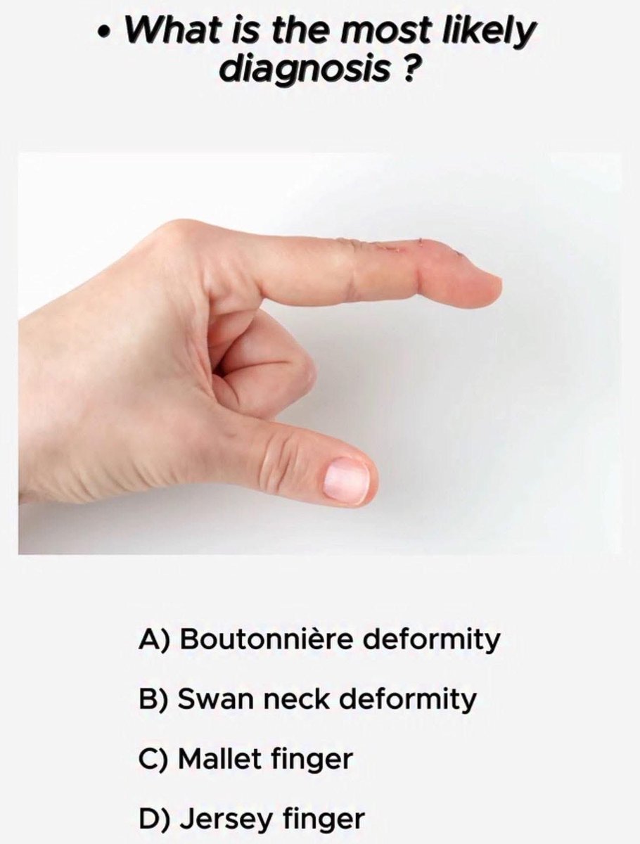 hemo_shk's tweet image. #MCQ

What is the most likely diagnosis?