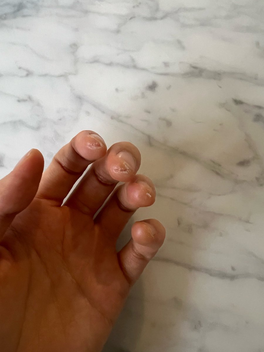 น้องซอส่งรูปมาในบับเบิ้ล บอกว่า ฉันทำดีที่สุดแล้ว 🎻❤️‍🔥 แล้วรูปสุดท้าย ปลายนิ้วของน้องซอที่บอบช้ำจากการฝึกฝนซ้อมมาอย่างหนัก น้องซอเก่งมาก 😭

#SEOHYUN #서현 #ซอฮยอน