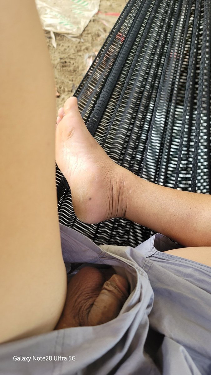 Love Penectomy tweet media