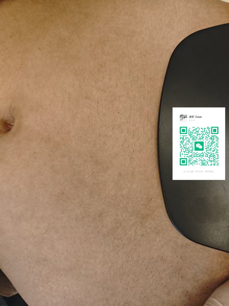 壹安（互推zhengzhou） tweet media