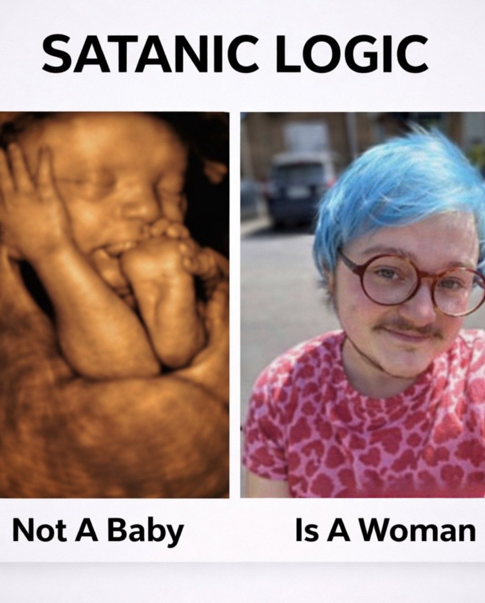 X Freeze tweet media