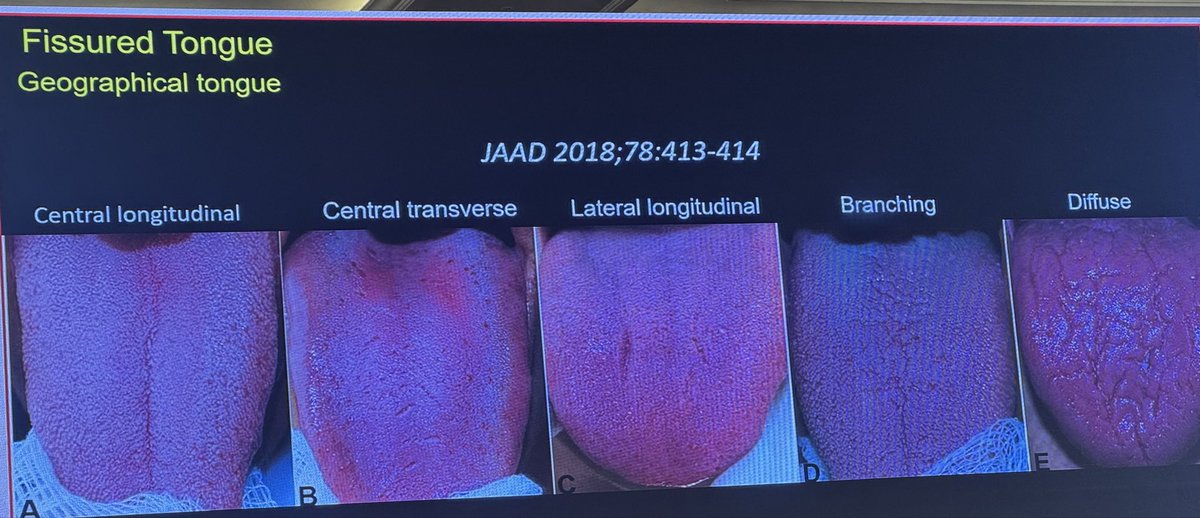 Dr Abhilasha Manwatkar (AIIMS Nagpur) tweet media