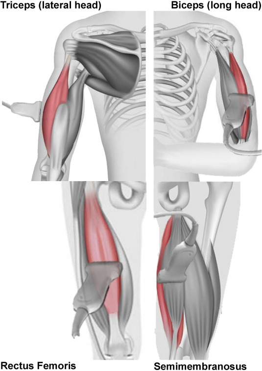 IFCN and its Clinical Neurophysiology journals tweet media
