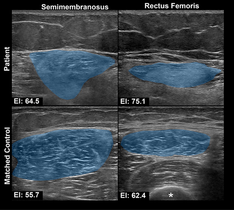 IFCN and its Clinical Neurophysiology journals tweet media